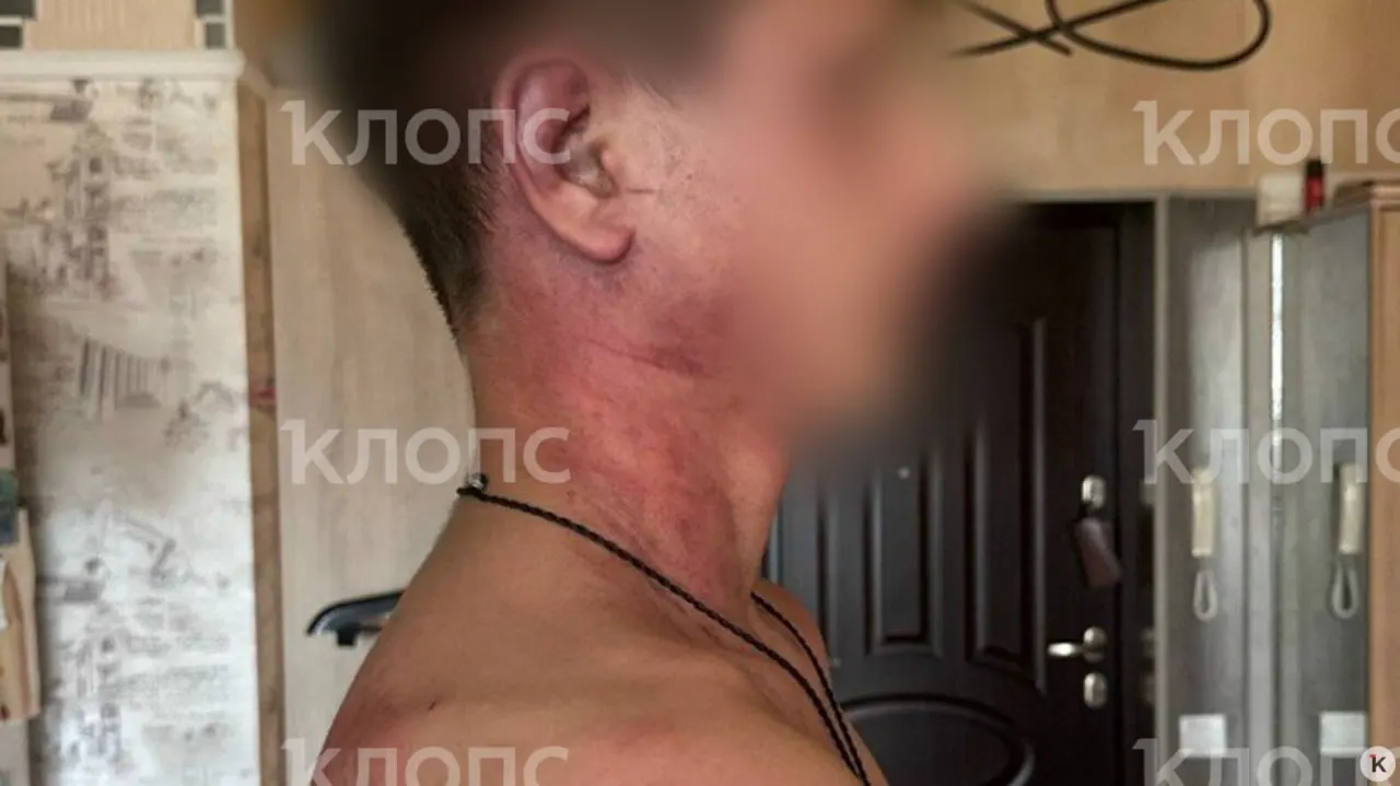 Мать утверждает, что ребёнка избили и душили; старший сын по решению суда жил с отцом. Инцидент произошёл на фоне спора об опеке, после нападения подростку поступают угрозы.